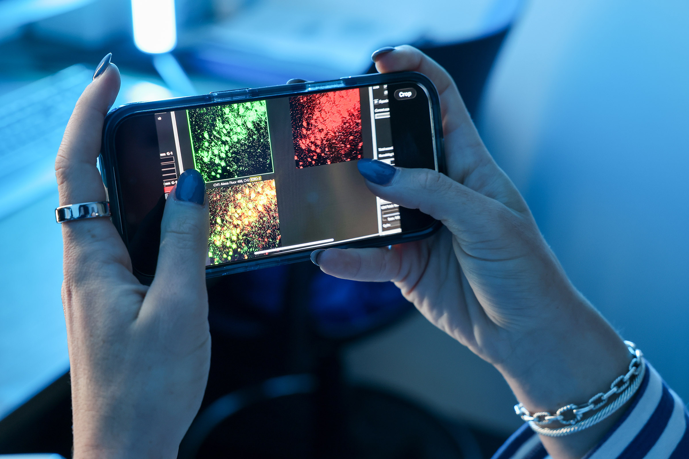 confocal microscope images